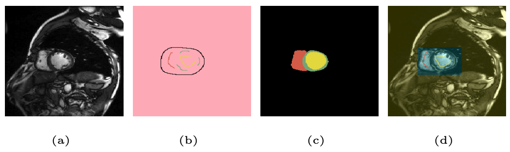 Scribble-supervised segmentation concept